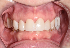 North Texas Dental Care | Root Canals, TMJ Disorders and Sleep Apnea