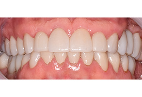 North Texas Dental Care | Sedation Dentistry, Cosmetic Dentistry and Laser Dentistry