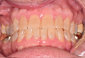 North Texas Dental Care | Cosmetic Dentistry, TMJ Disorders and Implant Dentistry