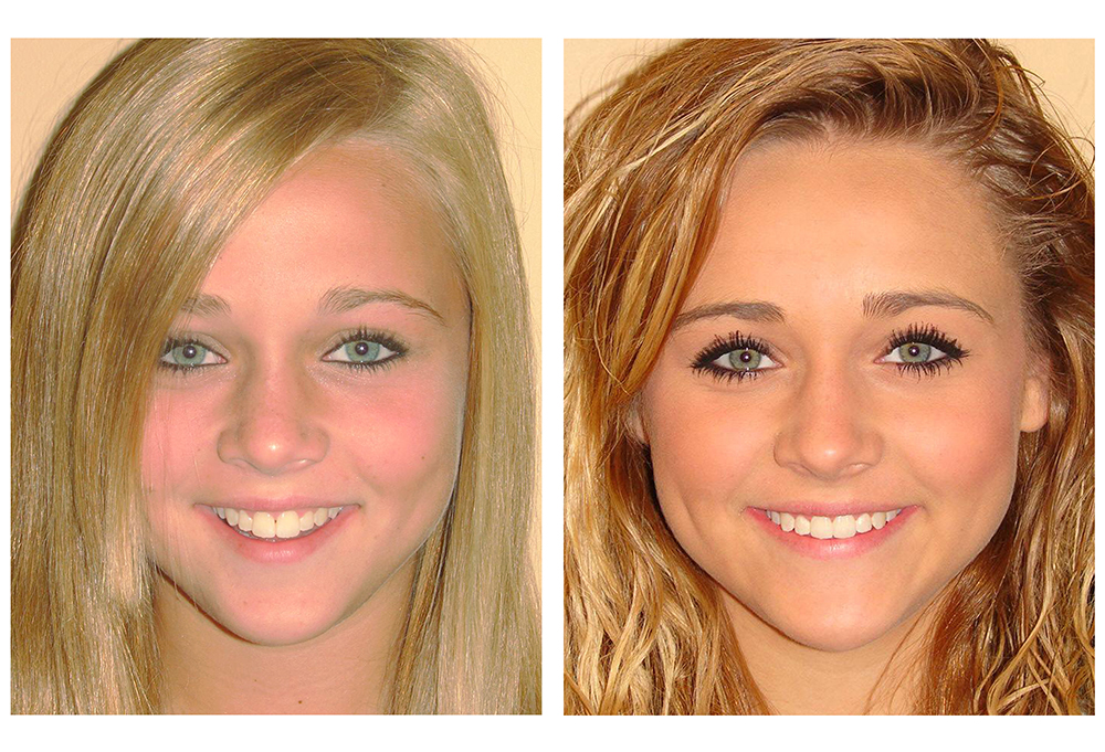 North Texas Dental Care