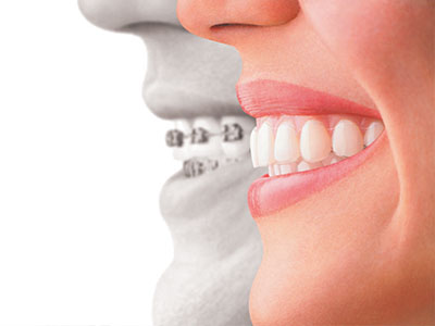 North Texas Dental Care | Extractions, Sports Mouthguards and Root Canals