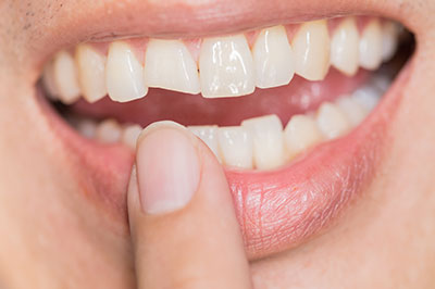 North Texas Dental Care | Same-Day Repairs, Sedation Dentistry and Implant Dentistry