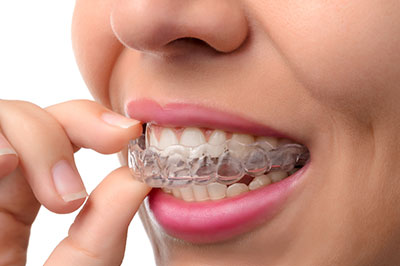 North Texas Dental Care | Laser Dentistry, Invisalign reg  and Root Canals