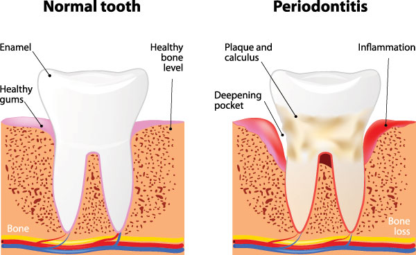 North Texas Dental Care | Night Guards, Cosmetic Dentistry and CEREC  