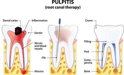 North Texas Dental Care | TMJ Disorders, Same-Day Repairs and Veneers