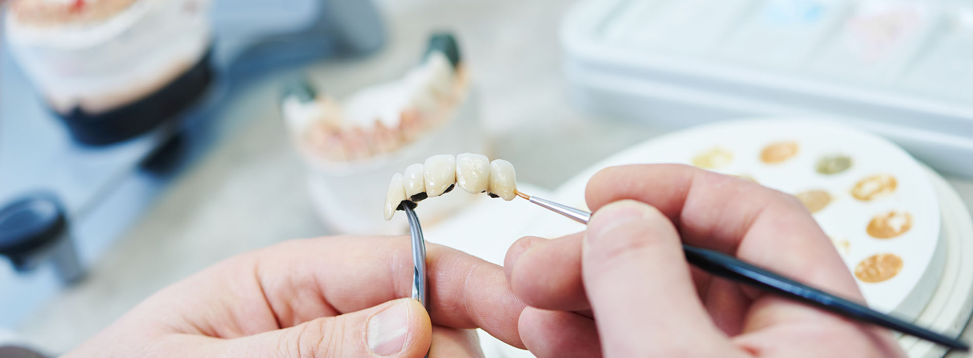 North Texas Dental Care | E4D, Teeth Whitening and Root Canals